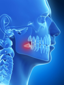 3d rendered illustration of the wisdom teeth
